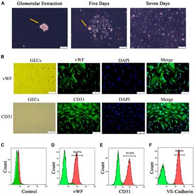 Saponins from Panax notoginseng ameliorate steroid resistance in lupus nephritis through regulating lymphocyte-derived exosomes in mice